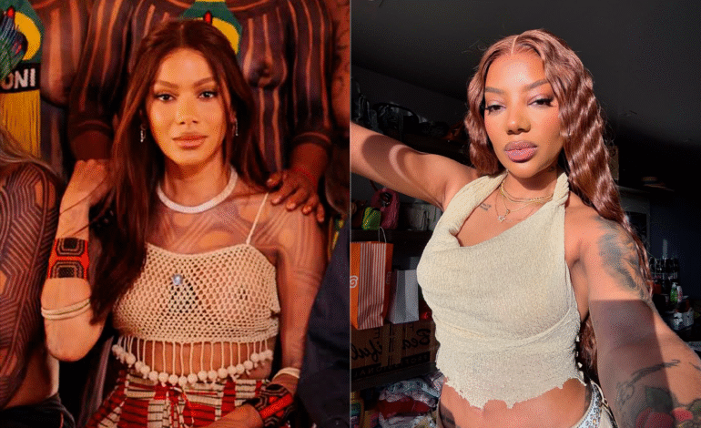 Anitta provoca debate ao mudar visual facial e ser comparada a Ludmilla