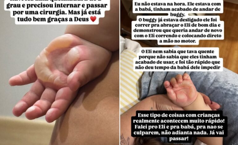O filho de Viih Tube e Eliezer sofreu uma queimadura