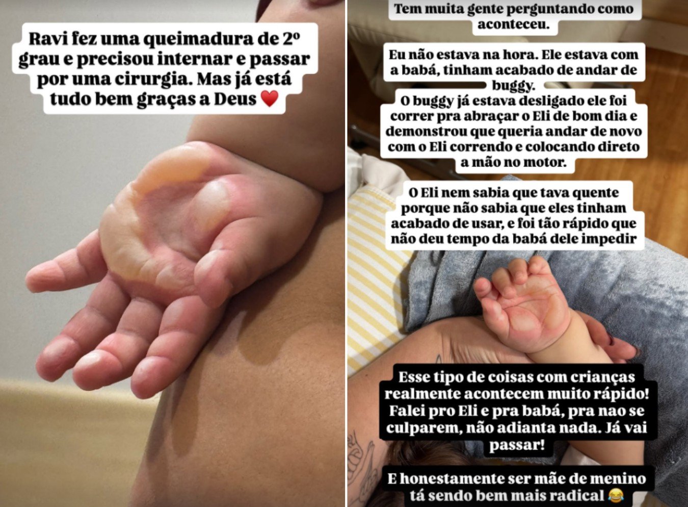 O filho de Viih Tube e Eliezer sofreu uma queimadura
