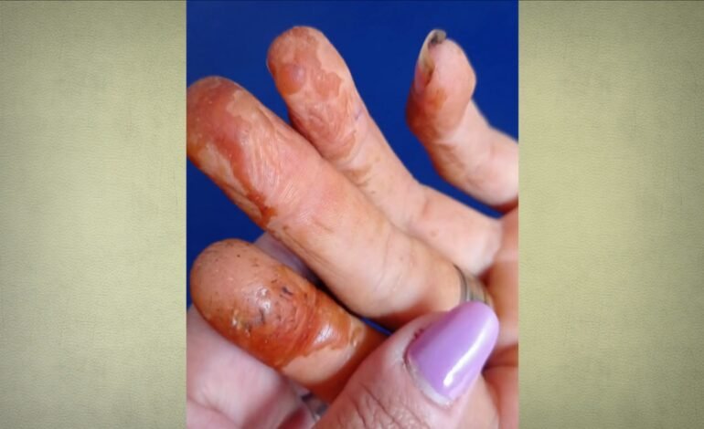 Pequenos produtores do semiárido do Rio Grande do