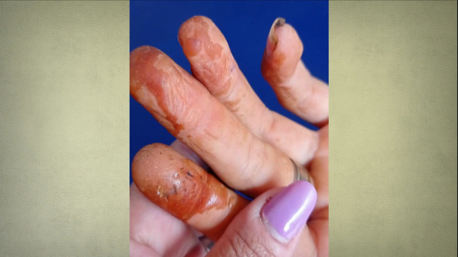 Pequenos produtores do semiárido do Rio Grande do