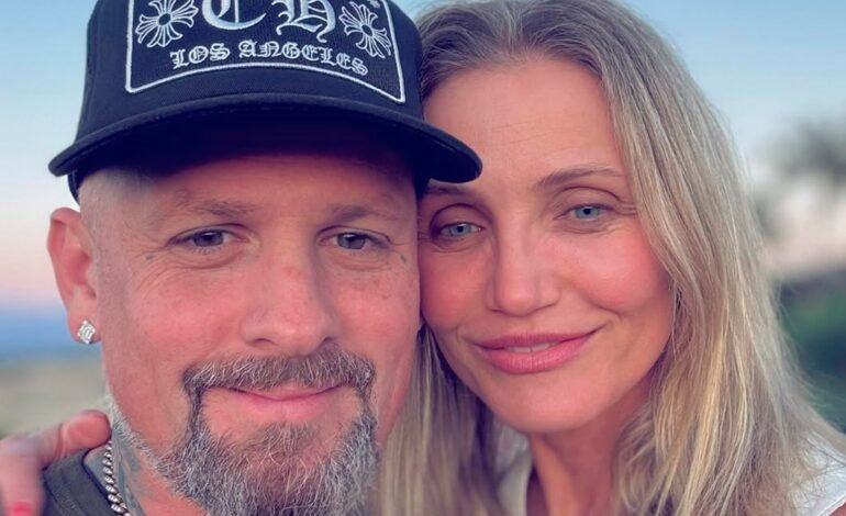 Benji Madden anunciou nesta segunda-feira (4) o nascimento