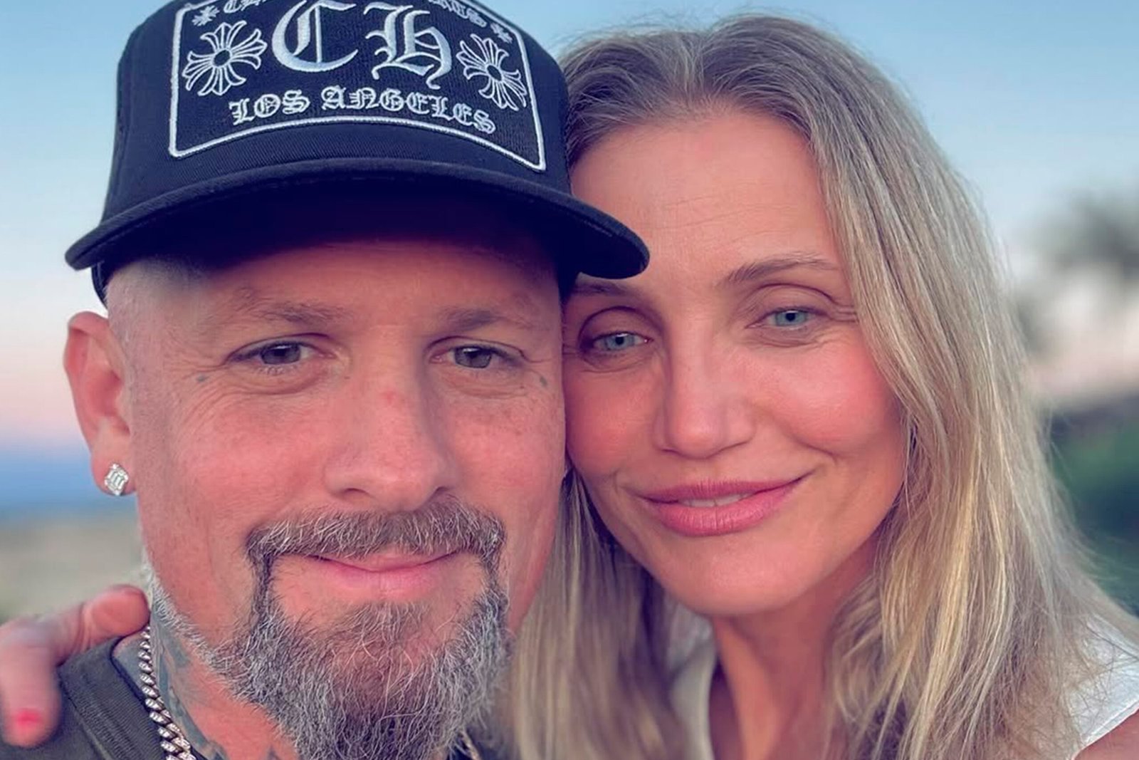 Benji Madden anunciou nesta segunda-feira (4) o nascimento
